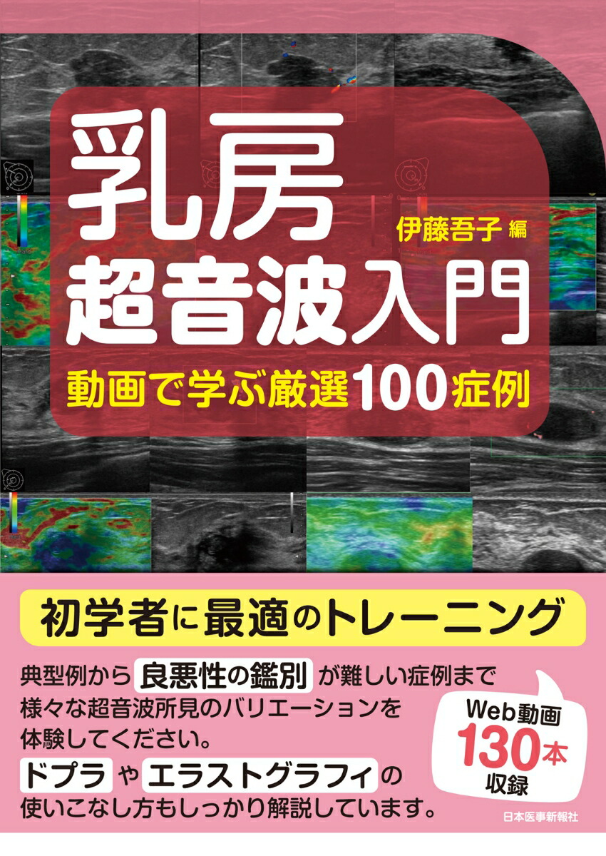 乳房超音波入門〈動画で学ぶ厳選100症例〉画像