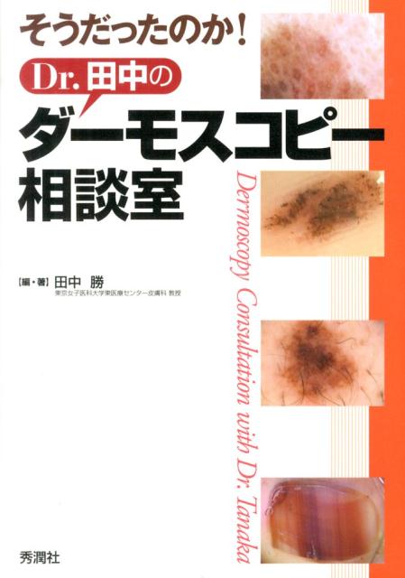 楽天ブックス: そうだったのか！Dr．田中のダーモスコピー相談室