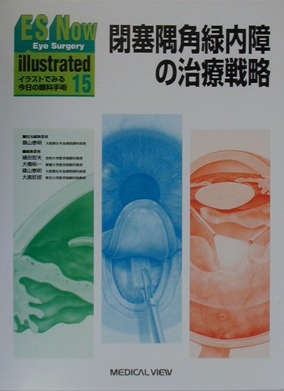 楽天ブックス Es Now Illustrated No 15 イラストでみる今日の眼科手術 樋田哲夫 本