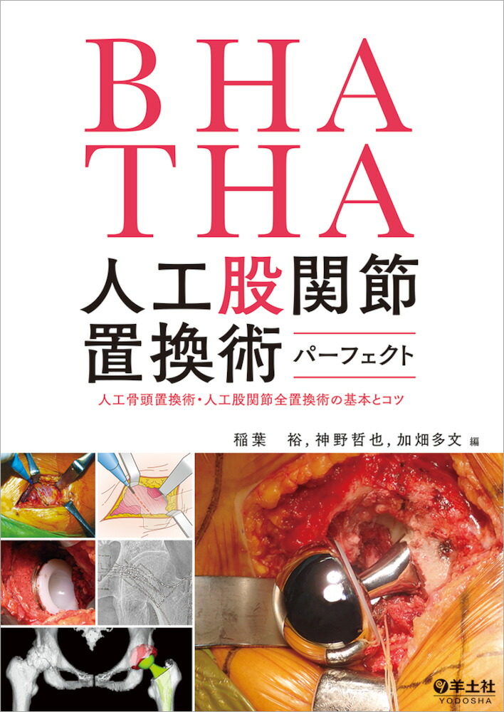 楽天市場】TKA・UKA人工膝関節置換術パーフェクト 人工膝関節全