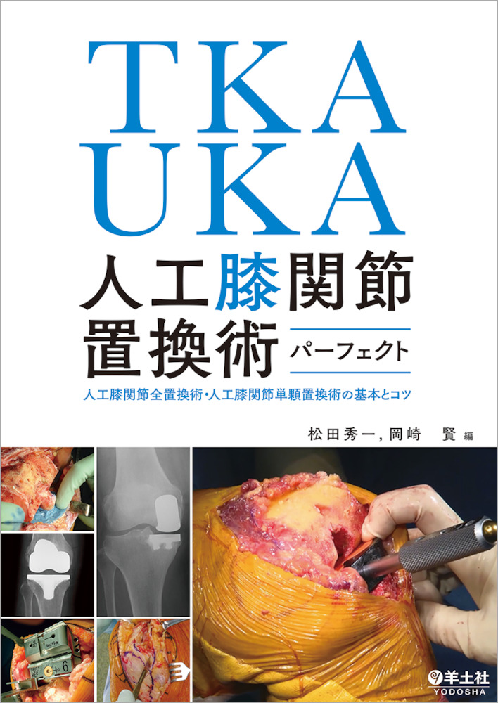 TKA・UKA　人工膝関節置換術パーフェクト画像