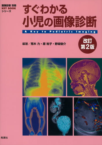 楽天ブックス: すぐわかる小児の画像診断 改訂第2版 - 荒木 力 - 9784780909012 : 本