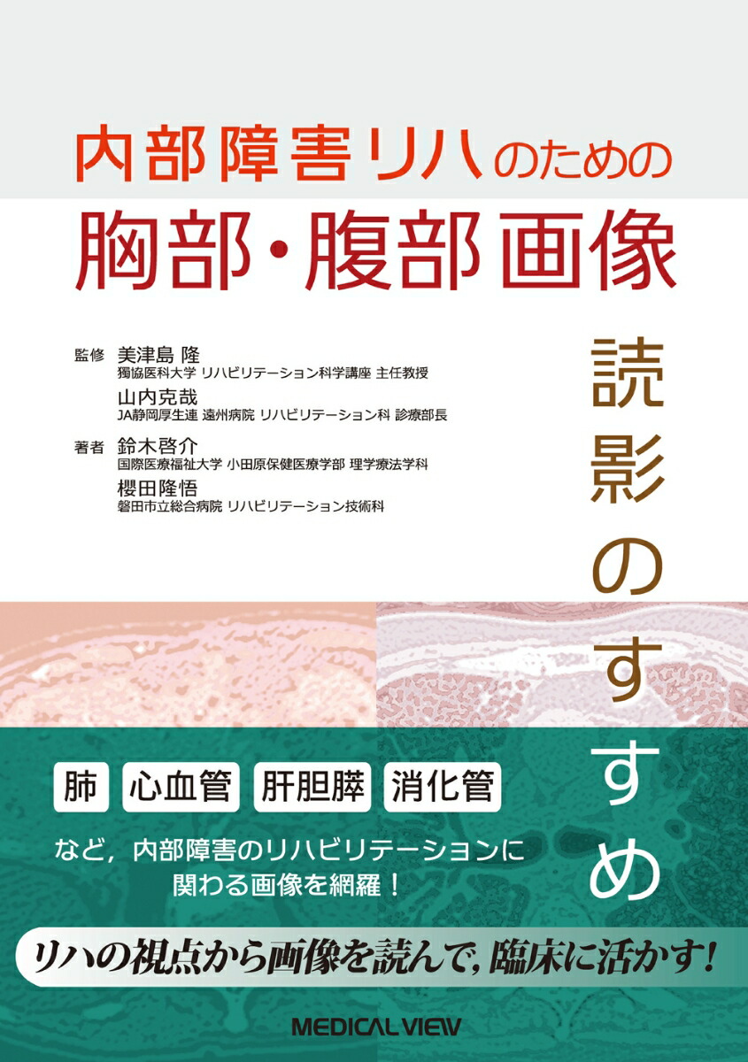 楽天ブックス: 内部障害リハのための 胸部・腹部画像 読影のすすめ