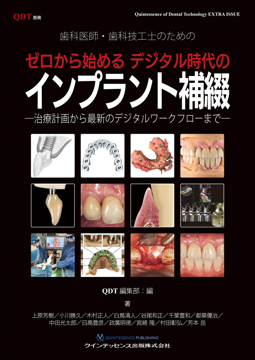 エビデンス・ベースト・インプラントロジー 41bAik1BJLL.jpg_BO30,255,255,