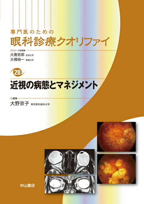 天ブックス: 近視の病態とマネジメント - 大野 京子 - 9784521739250 