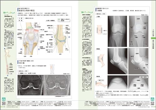 病気がみえる（vol.11）運動器・整形外科[医療情報科学研究所]