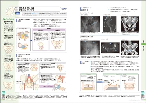 病気がみえる（vol.11）運動器・整形外科[医療情報科学研究所]