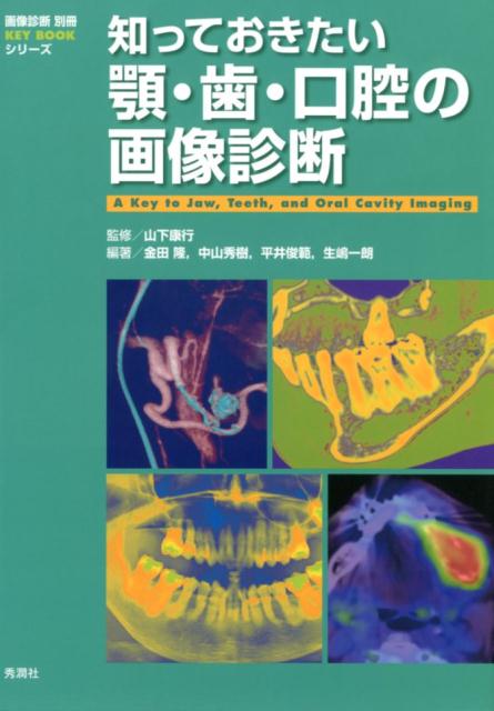 楽天市場】[書籍] イラストでみる口腔外科手術 第4巻【送料無料