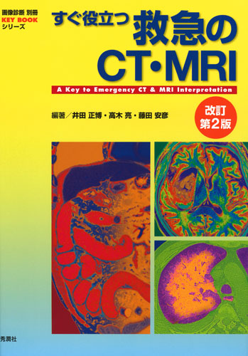 楽天ブックス: すぐ役立つ救急のCT・MRI 改訂第2版 - 井田正博