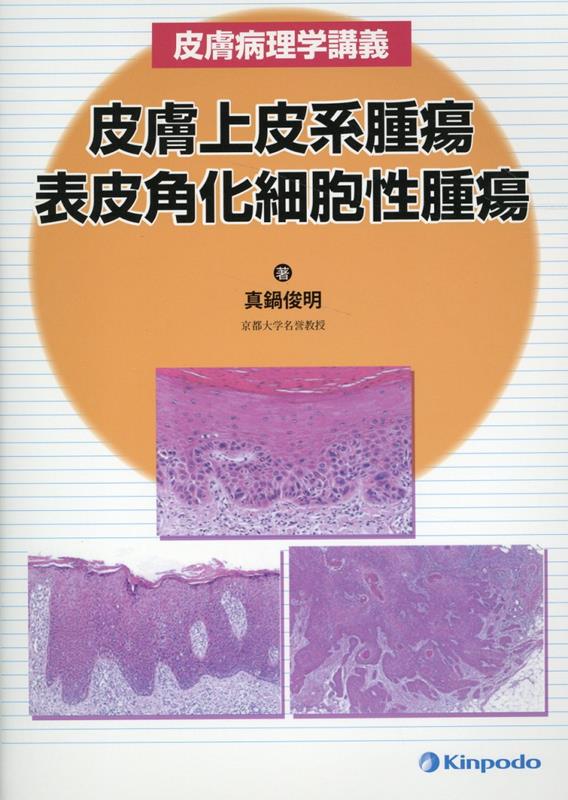 楽天市場】皮膚外科のための皮膚軟部腫瘍診断の基礎(PEPARS(ペパーズ