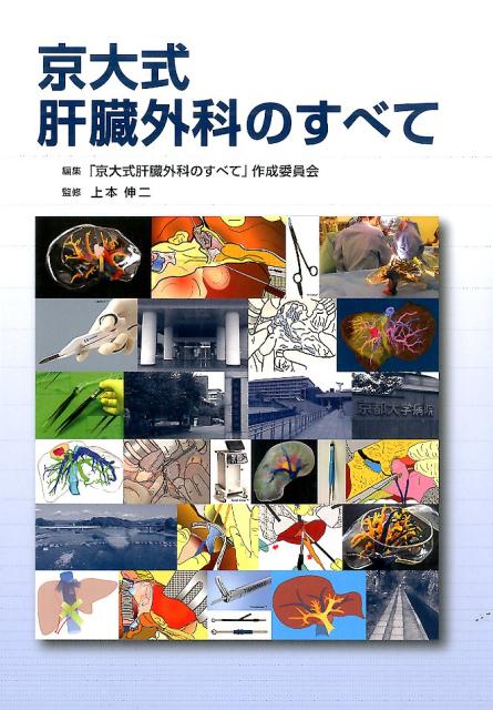 京大式肝臓外科のすべて 楽天ブックス: 京大式肝臓外科のすべて - 「京大式肝臓外科のすべて