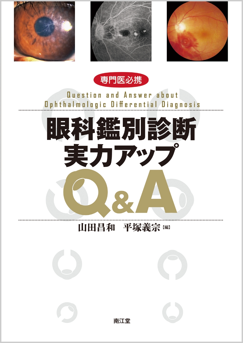 眼科専門医への最短コース 眼科専門医認定試験問題集 第23～30回