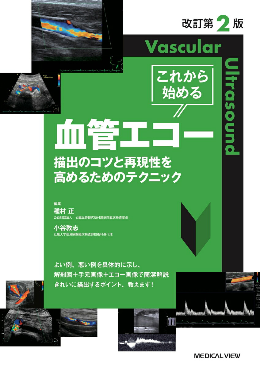 楽天市場】臨床のための頸動脈エコー測定法 第2版 : 参考書専門