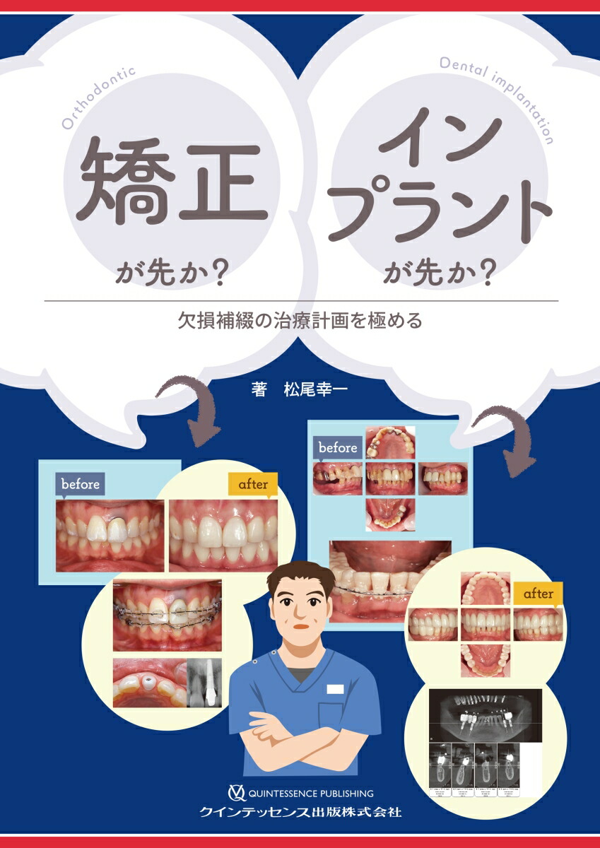 楽天ブックス: 矯正が先か？ インプラントが先か？ - 欠損補綴の治療