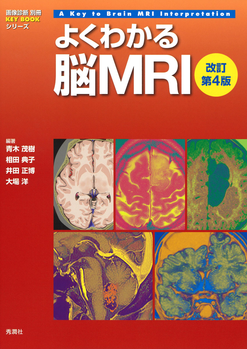 よくわかる脳MRI　改訂第4版 （画像診断別冊KEYBOOKシリーズ）