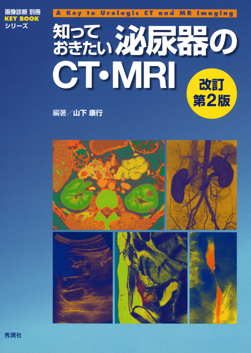 知っておきたい泌尿器のCT・MRI (画像診断別冊KEY BOOKシリーズ