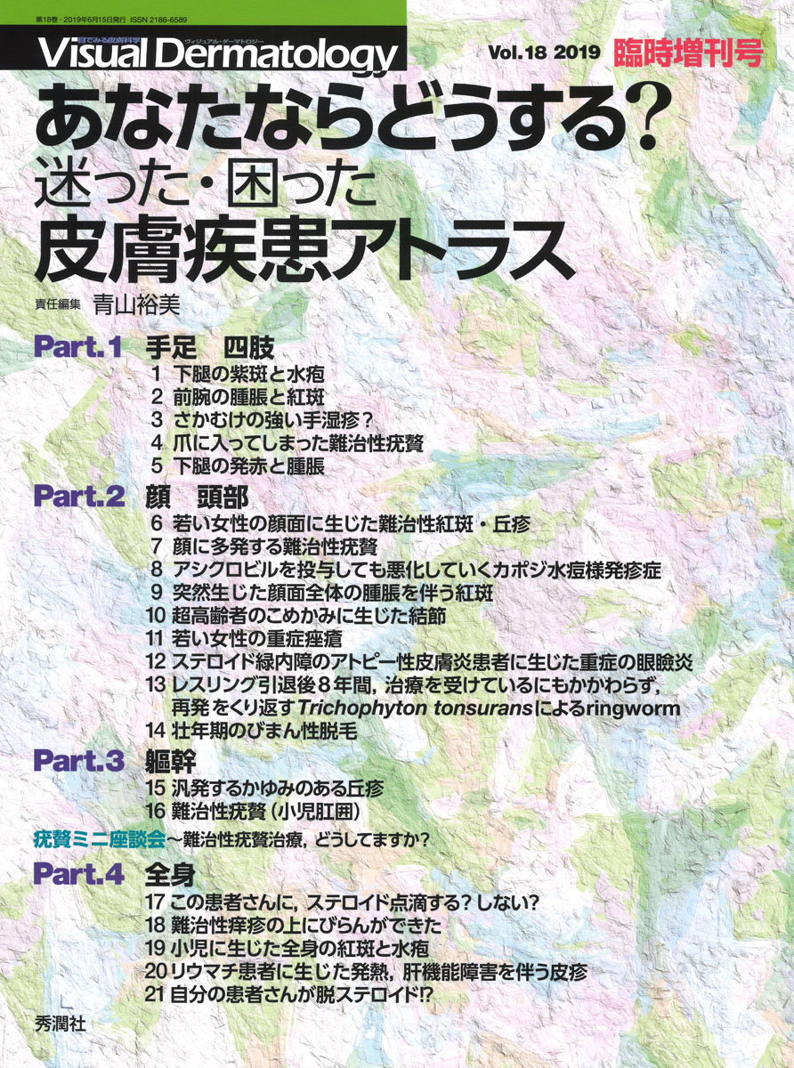 臨床皮膚科 2020年 4月号増刊号 特集 最近のトピックス2020 楽天市場】臨床皮膚科 2020年 4月号増刊号 特集 最近の