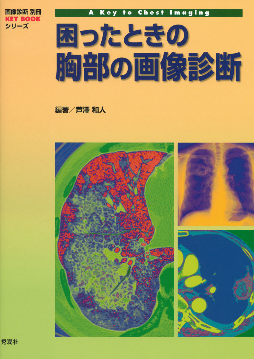 楽天ブックス: 困ったときの胸部の画像診断 - 芦澤和人