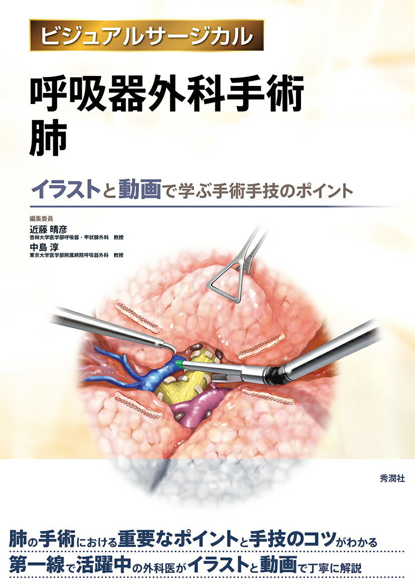 楽天ブックス: 呼吸器外科手術 肺 - 近藤晴彦 - 9784780909852 : 本