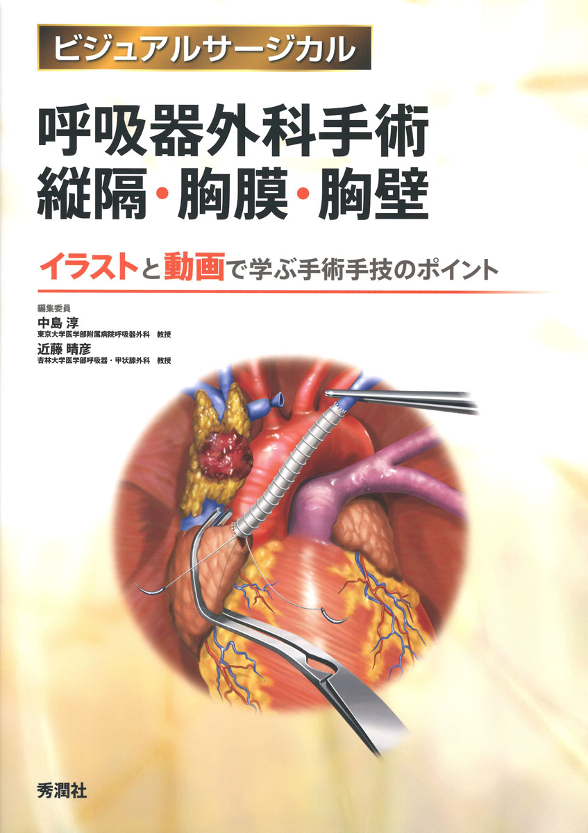 楽天ブックス: 呼吸器外科手術 縦隔・胸膜・胸壁 - 中島 淳 