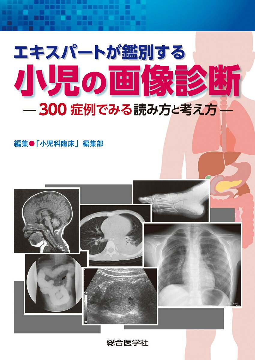 楽天ブックス: エキスパートが鑑別する 小児の画像診断 - 300症例で