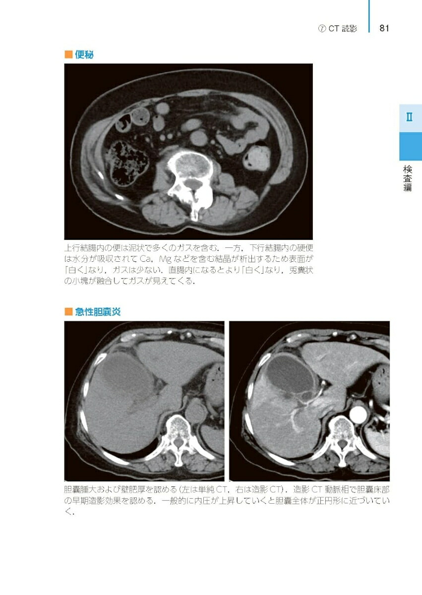 京都ERポケットブック 第2版 京都ERポケットブック 第2版 健康・医学