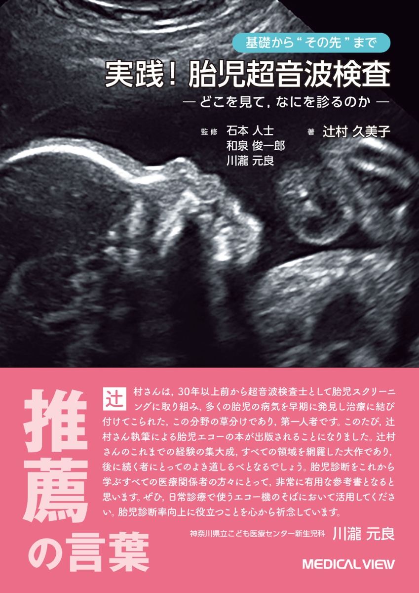 楽天ブックス 基礎から その先 まで 実践 胎児超音波検査 ーどこを見て なにを診るのかー 辻村 久美子 本