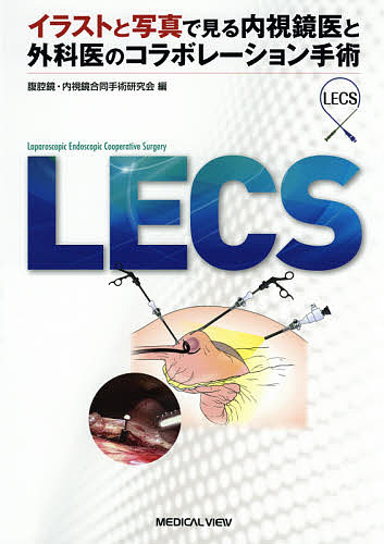 代引不可 Lecs イラストと写真で見る内視鏡医と外科医のコラボレーション手術 腹腔鏡 内視鏡合同手術研究会 1000円以上 人気ショップが最安値挑戦 Elanguageworld Com