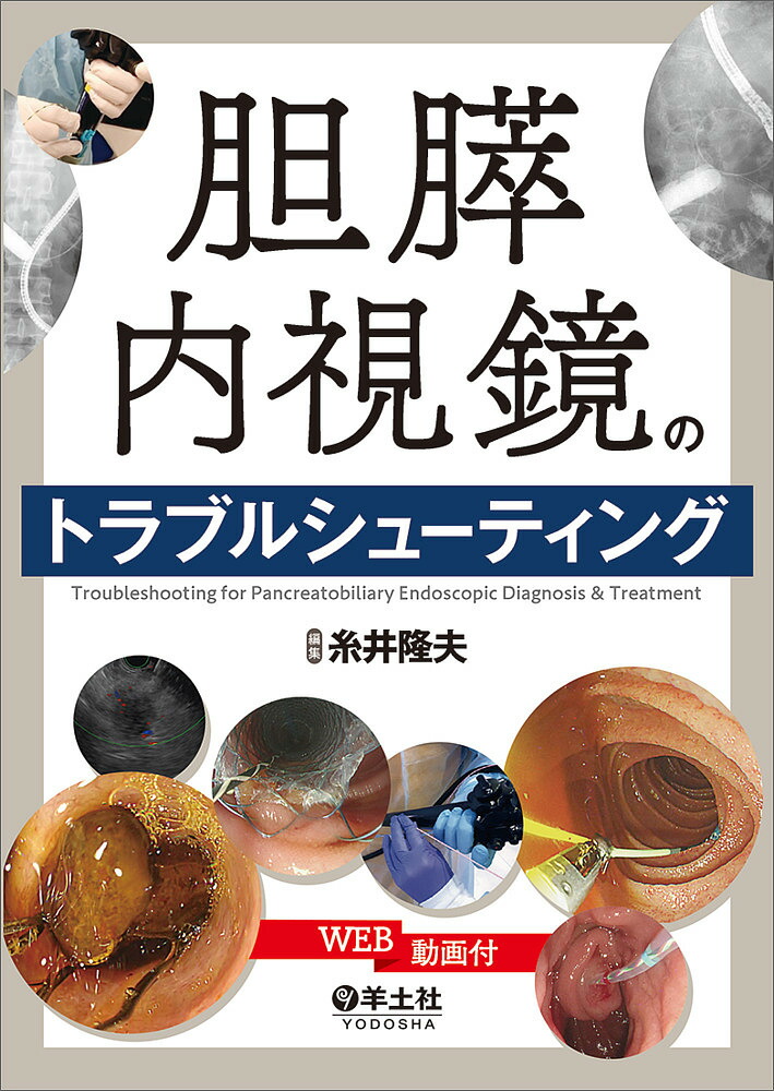 楽天市場】これで完璧!胆膵内視鏡の基本とコツ “うまくいかない”を解決
