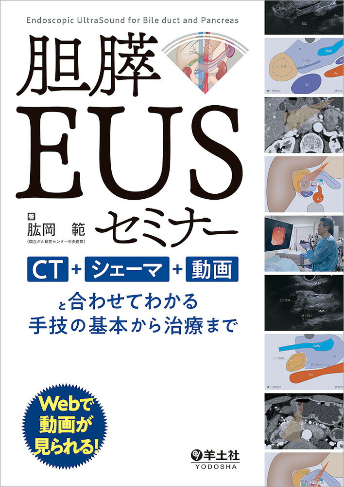 楽天市場】これで完璧!胆膵内視鏡の基本とコツ “うまくいかない”を解決