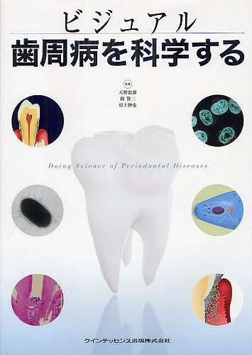 ビジュアル歯周病を科学する 天野敦雄 岡賢二 村上伸也 3000円以上送料無料 Factor100 Co Il