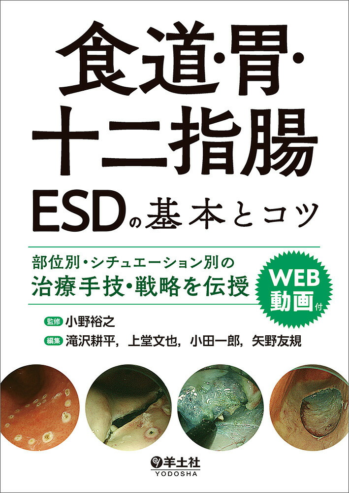 楽天市場】ザ・テキスト食道・胃・十二指腸ESD : ぐるぐる王国FS 楽天
