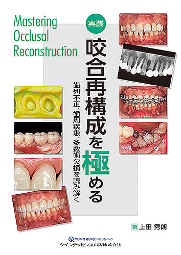 楽天市場】【中古】（新古品・未使用品） 実践 咬合再構成を