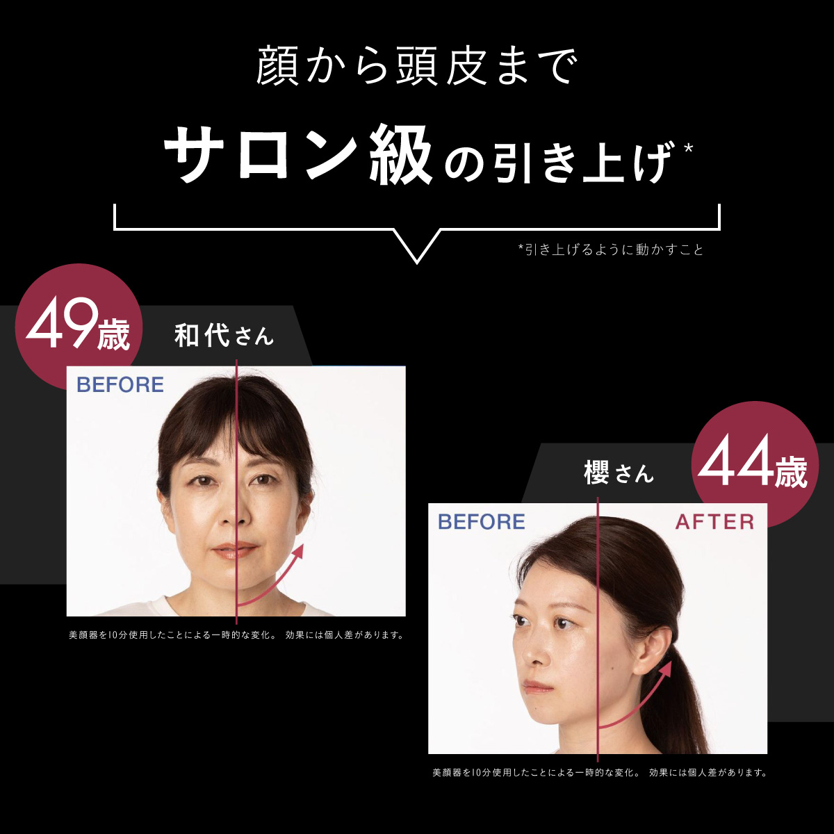 今なら40,800円相当！＞＼新色登場／【公式】美顔器 リフトアップ