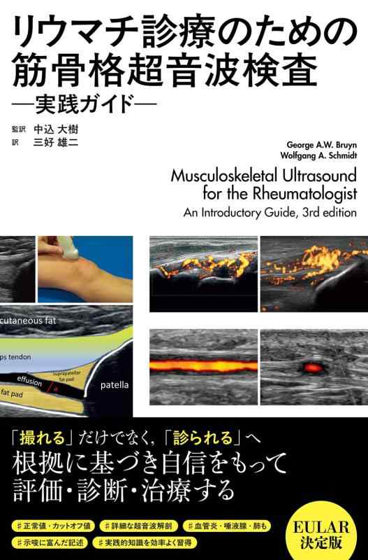 【中古】リウマチ診療のための筋骨格超音波検査 &mdash;実践ガイド &mdash;｜ブリルビ