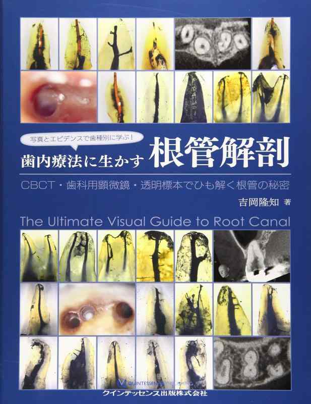 【中古】写真とエビデンスで歯種別に学ぶ 歯内療法に生かす根管解剖|ブリルビ
