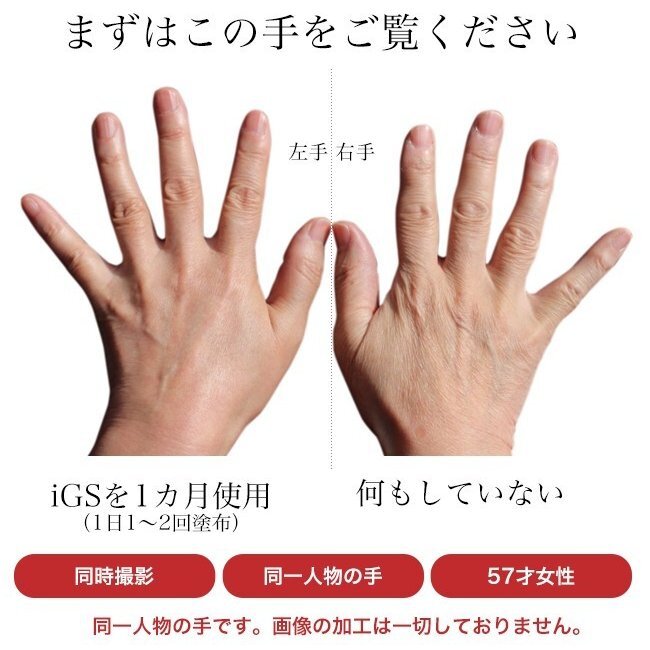 激安単価で ポイント15倍 フィジカル Igs4000gel 美容用ジェル 3g 60包 公式店舗 Neweurasia Info