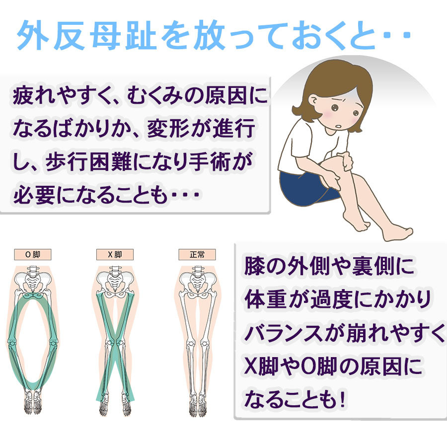 足指サポーター シリコン 足指 広げる グッズ 足 効果 足指パッド 両足セット 国内正規品 寝る 外反母趾