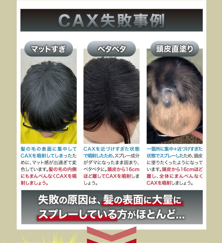 楽天市場 ホンマでっか Tvで紹介 瞬間増毛 Cax カックス 1本 ブラック 増毛スプレー 薄毛スプレー ハゲ隠し 薄毛隠し 増毛パウダー ボリュームアップ ヘアスプレー 髪を太く見せ 地肌を隠す 白髪 薄毛セット 薄毛髪型 薄毛対策 薄毛改善 増毛ふりかけ 耐水 育毛剤や