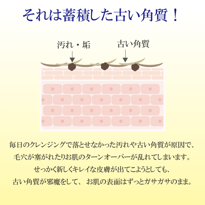 人気が高い 角質ケア 角質除去 角質とり 角栓 柚子 ゆず 顔 鼻 洗顔 毛穴 黒ずみ ニキビ 人気 ナチュラル 自然 天然 敏感肌 クリーム デリケートゾーン うるおい 小じわ 美容液 素肌感 化粧水 Cure ゴマージュ ポロポロ ぶつぶつ アクアジェル クロフィア 店