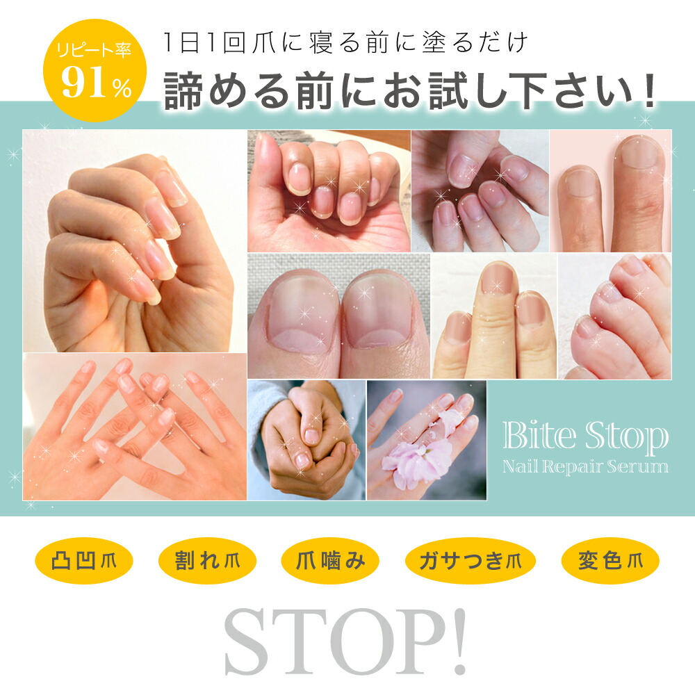 楽天市場 爪美容液 Bitestop ネイルリペアセラム 10ml 爪の保護 爪噛み防止 ネイルケア コスメティクスラボ 楽天市場 爪美容液 Bitestop ネイルリペアセラム 10ml 爪の保護 爪噛み防止 ネイルケア コスメティクスラボ