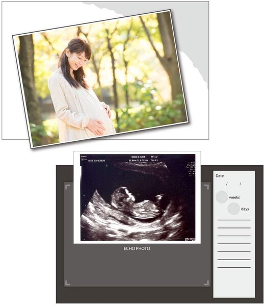 市場 1000円以上お買い上げで送料無料 Mom エコー写真アルバム ディズニー サンスター文具 アンドマム