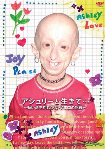 【中古】アシュリーと生きて・・・ ~短い命を刻む少女・7年間の記録~ [DVD]
