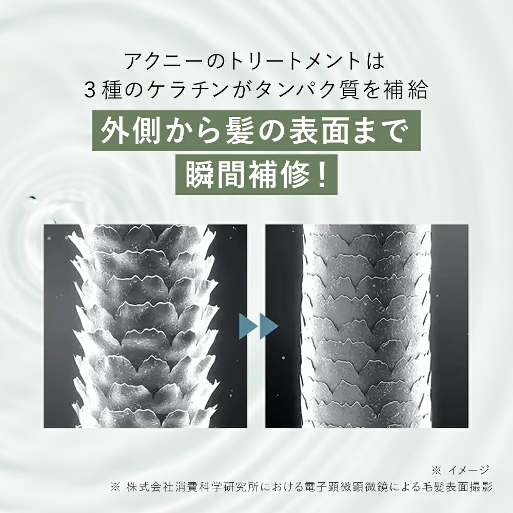 楽天ランキング1位】AKNIR アクニー 梨花開発 薬用シャンプー