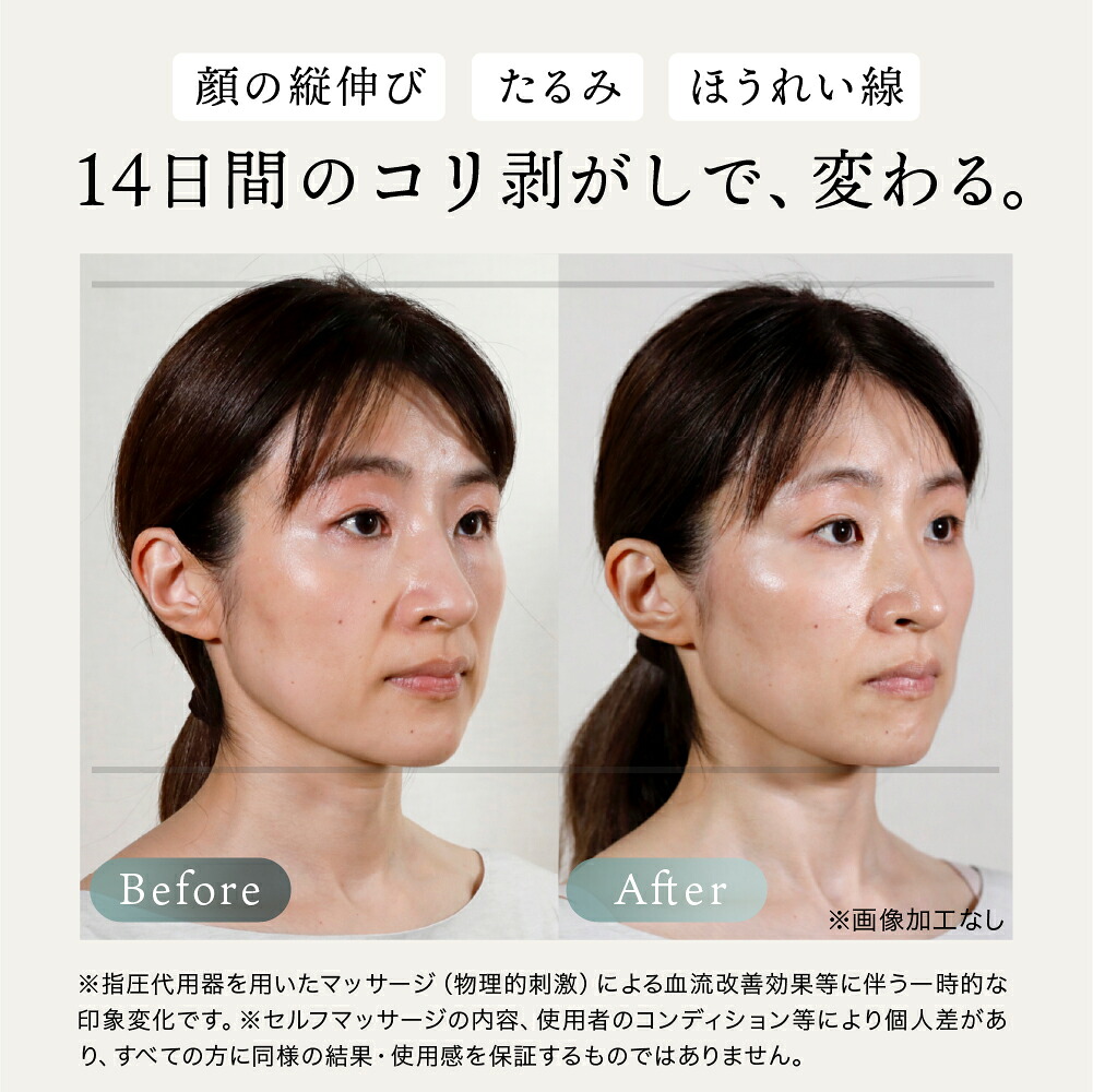 正規品】The FACE POiNTER® ｜ポスポス フェイスポインター ほうれい線