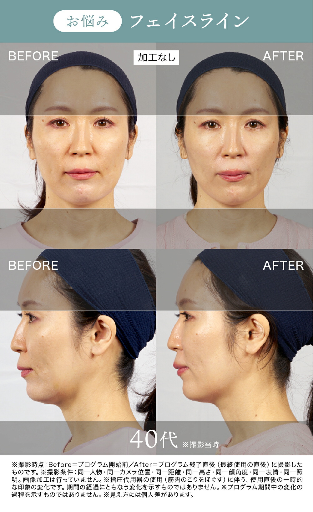 正規品 The FACE POiNTER® ｜ポスポス フェイスポインター 表情筋の
