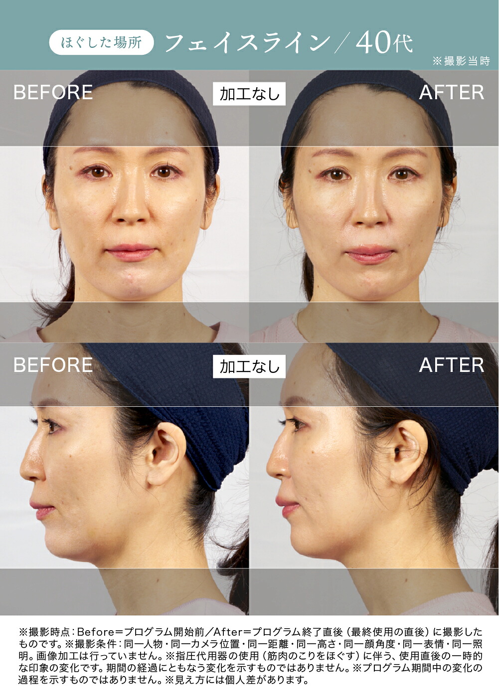 正規品 The FACE POiNTER® ｜ポスポス フェイスポインター 表情筋の