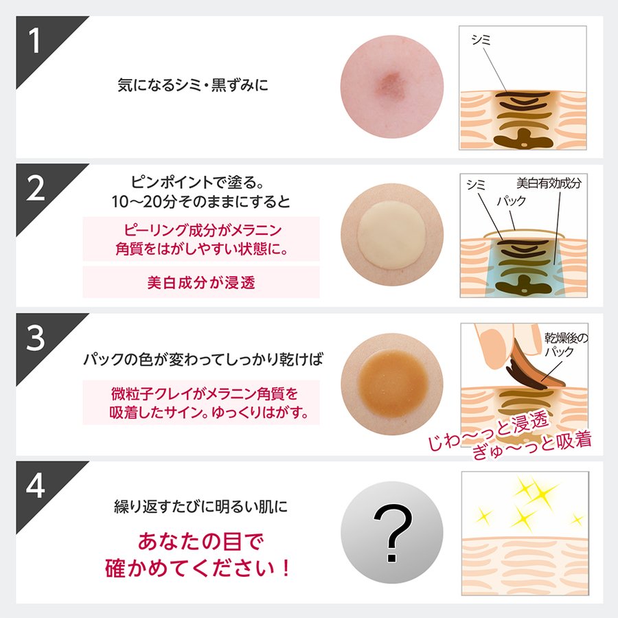 人気が高い 販売累計10万個突破 公式 レディブラン 薬用 美白 ピールホワイト 3本セット シミ取り 黒ずみ Aha クレイ ホワイトニング シミ 消す 楽天市場 Www Faan Gov Ng