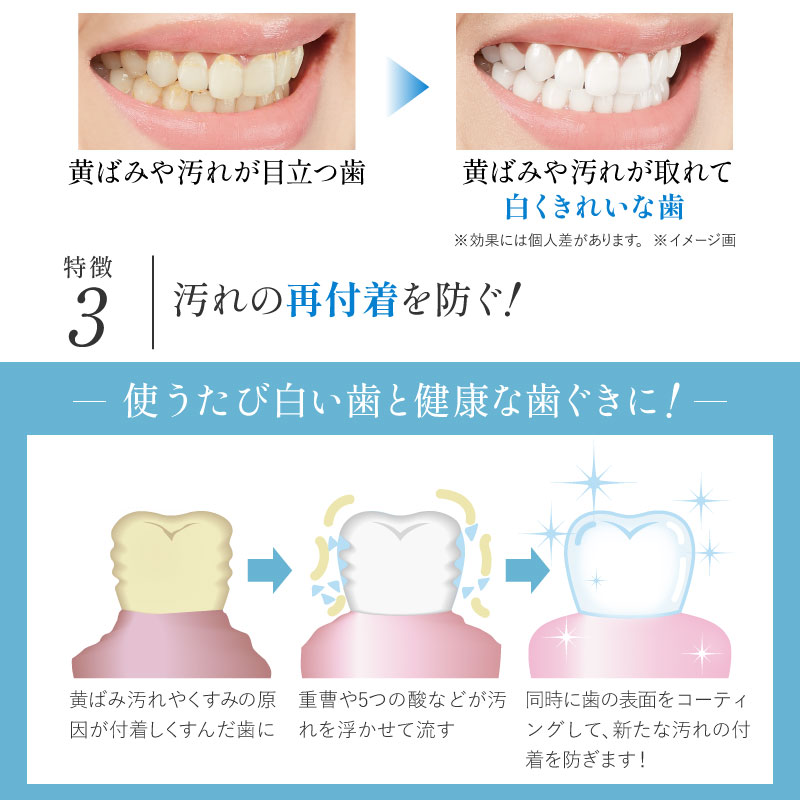 94％以上節約 ホワイトニング マウスウォッシュ 口臭ケア 歯 ヤニ取り 黄ばみ 口臭 原因を洗い流す 重曹 美白洗浄液 口腔洗浄液 歯周病予防  医薬部外品 薬用 デンタリンス 300ml 3本セット aquilanidus.com