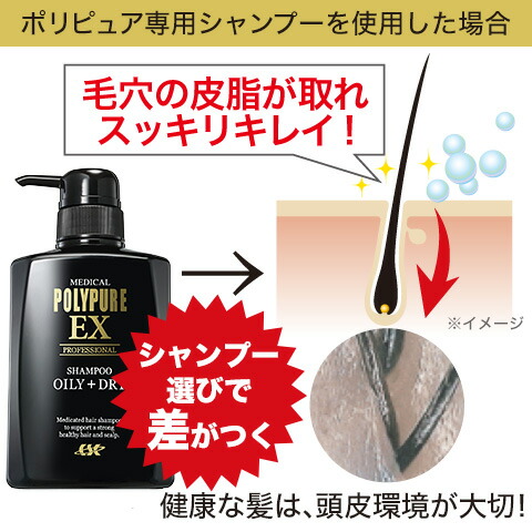 【ポイント10倍／送料無料】＜定期購入＞ポリピュアEX 薬用スカルプシャンプー[脂性肌用/乾燥肌用] 人気 薬用シャンプー 男性用シャンプー 頭皮ケア ふけかゆみ メンズ スカルプケア オイリー ドライ ヘアケア 医薬部外品 ノンシリコン ［期間限定］